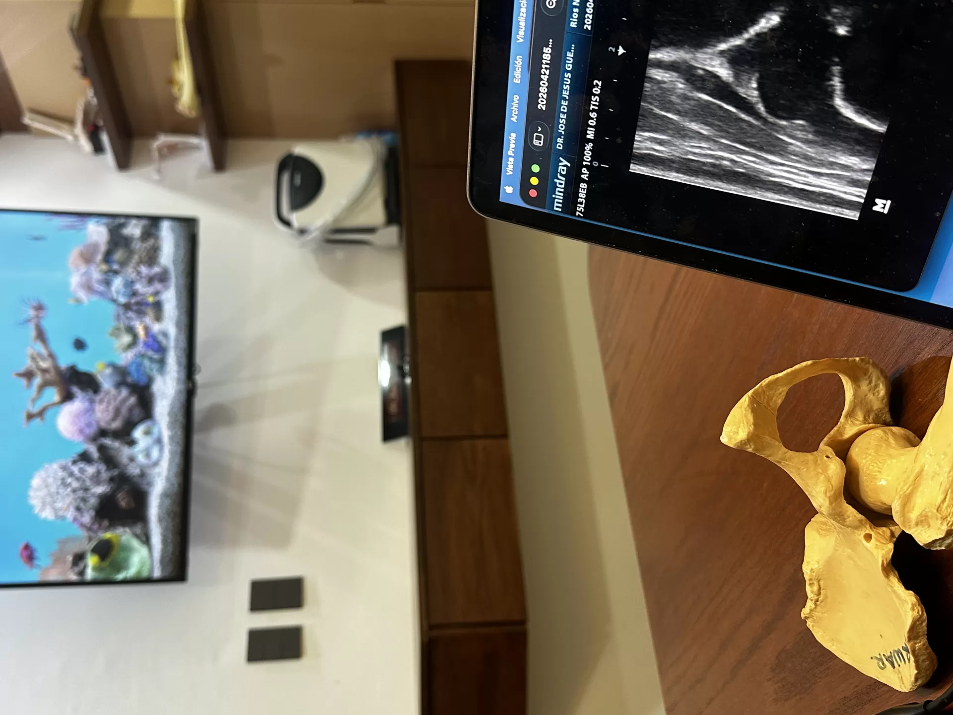 Ultrasonido de cadera en consultorio del Dr. Jes&uacute;s Guerra